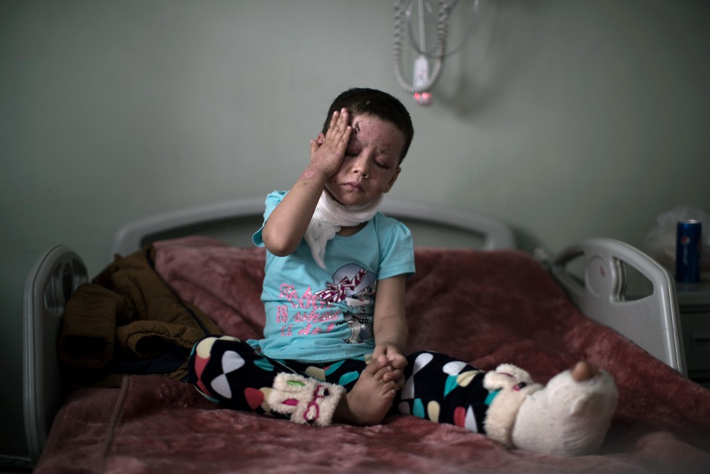 FILE - Hawra Alaa Hassan, 4-years–old, who was badly burned in a U.S. airstrike in Mosul, sits on her bed at a hospital in Irbil, Iraq, in this file photo from Saturday, April 8, 2017. Accounts from survivors and witnesses cast doubt on U.S. suggestions that the Islamic State group was to blame for the high civilian death toll in the March 17 strike, which leveled a house where more than 100 people were taking refuge, killing almost all, in the deadliest single incident in the months-long campaign to retake Mosul.  (AP Photo/Felipe Dana, File)